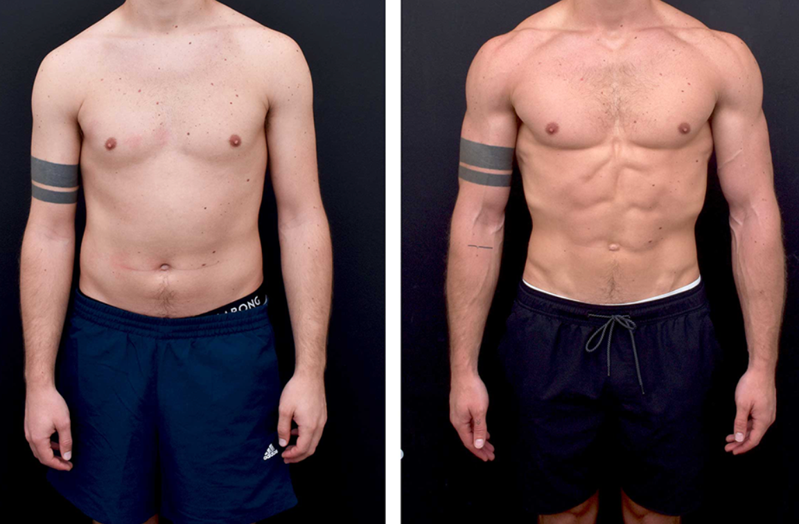 PERFECT WEIGHT PLATINUM PROGRAM